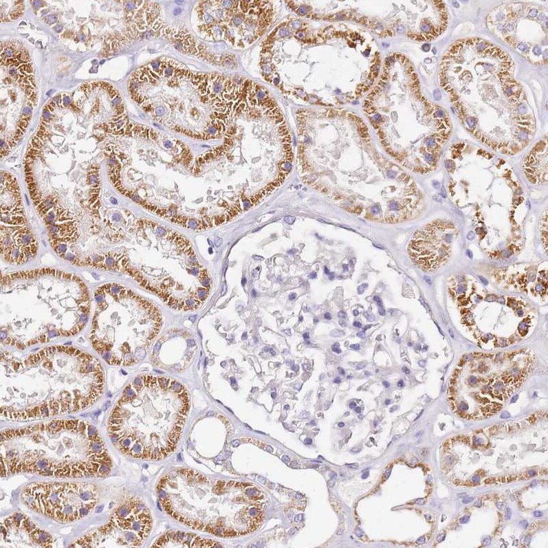 OR2B11 Antibody - BSA Free Immunohistochemistry: OR2B11 Antibody - BSA Free [NBP1-92225]