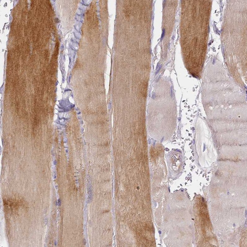 OR2B11 Antibody - BSA Free Immunohistochemistry: OR2B11 Antibody - BSA Free [NBP1-92225]