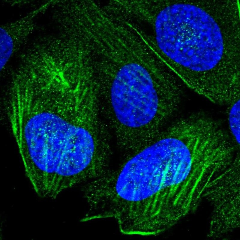P2X4 Antibody - BSA Free Immunocytochemistry/ Immunofluorescence: P2X4 Antibody [NBP1-92239]