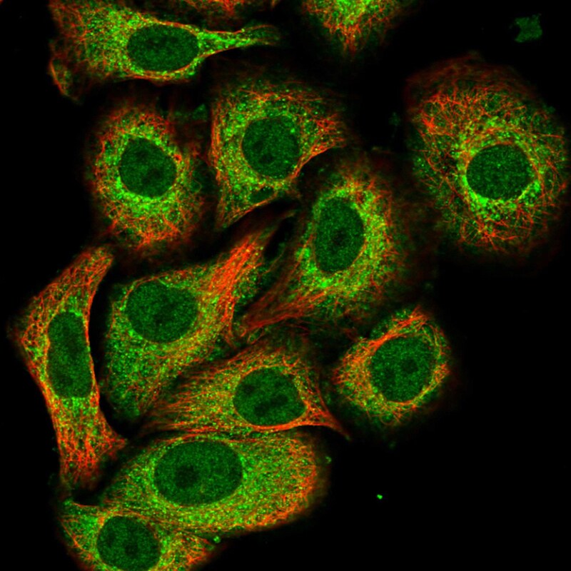 PAD3 Antibody - BSA Free Immunocytochemistry/ Immunofluorescence: PAD3 Antibody - BSA Free [NBP1-92240]