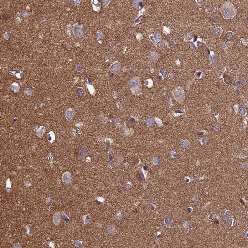 PCDHA5 Antibody - BSA Free Immunohistochemistry: PCDHA5 Antibody - BSA Free [NBP1-92244]