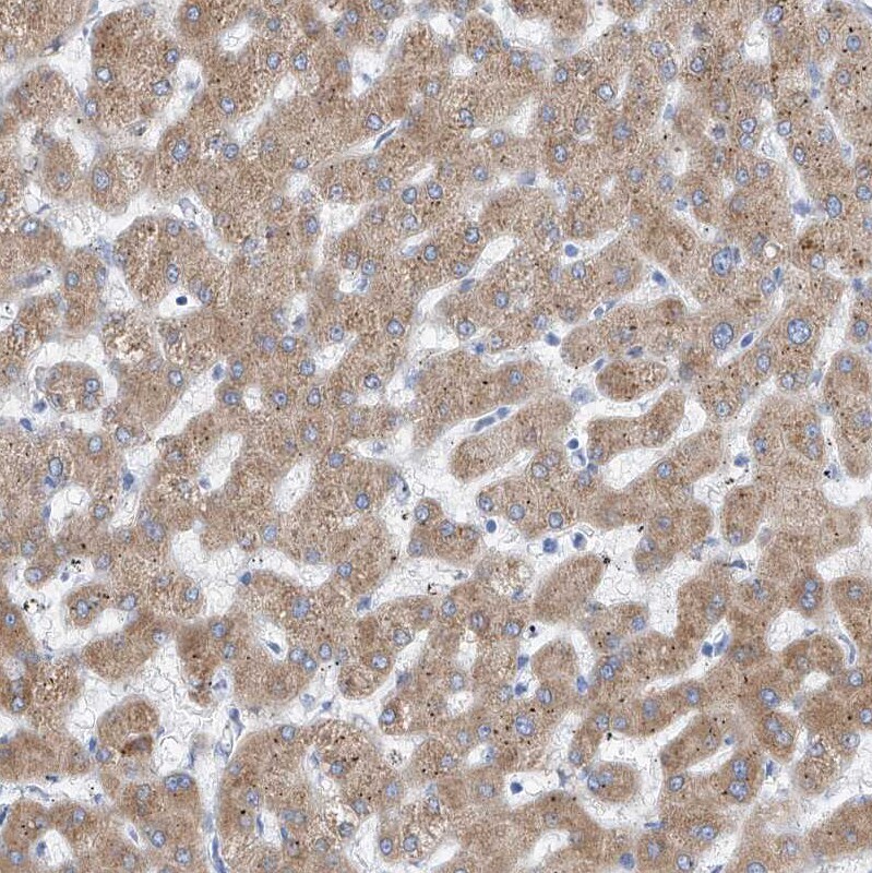 PDIR Antibody