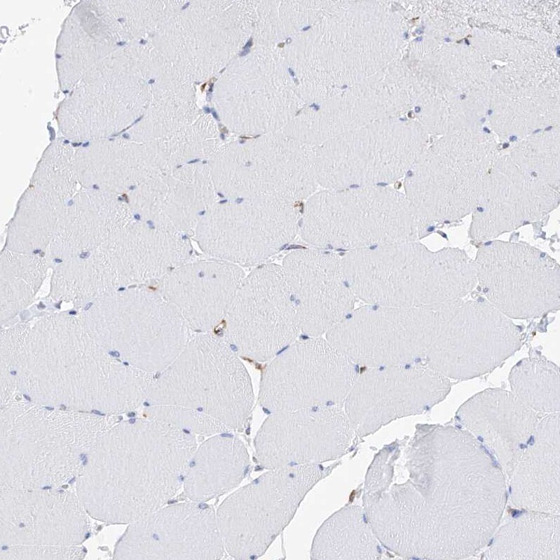 PDIR Antibody