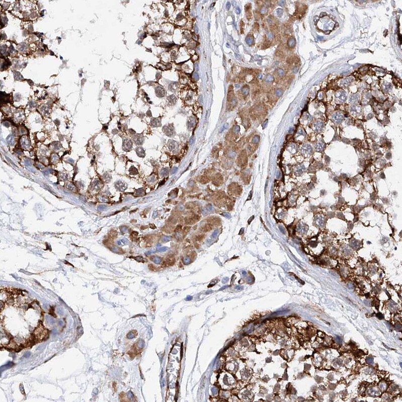 PDIR Antibody