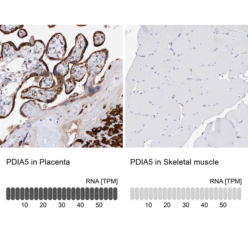 PDIR Antibody - BSA Free Immunohistochemistry: PDIR Antibody - BSA Free [NBP1-92252]