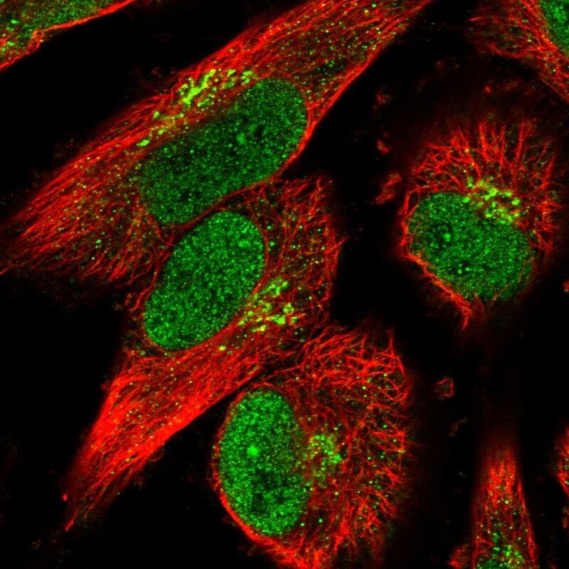 PDIR Antibody - BSA Free Immunocytochemistry/ Immunofluorescence: PDIR Antibody - BSA Free [NBP1-92252]