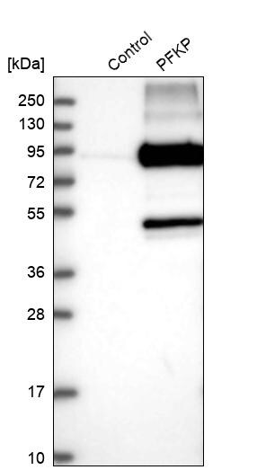 PFKP Antibody - BSA Free Western Blot: PFKP Antibody - BSA Free [NBP1-92256]