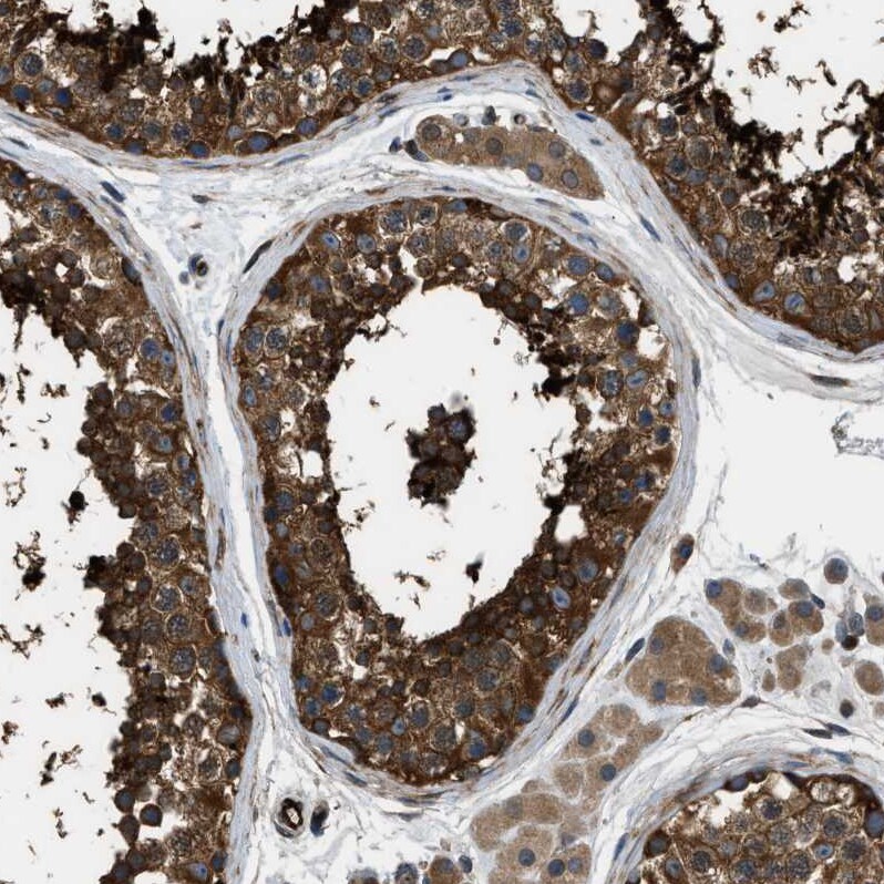 PFKP Antibody - BSA Free Immunohistochemistry: PFKP Antibody - BSA Free [NBP1-92256]