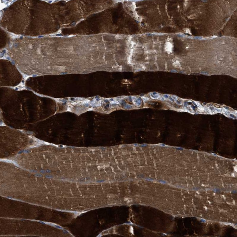 PFKP Antibody - BSA Free Immunohistochemistry: PFKP Antibody - BSA Free [NBP1-92256]