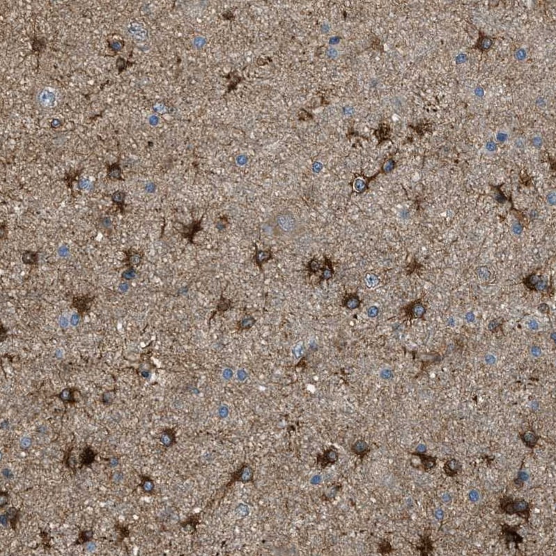 PFKP Antibody - BSA Free Immunohistochemistry: PFKP Antibody - BSA Free [NBP1-92256]