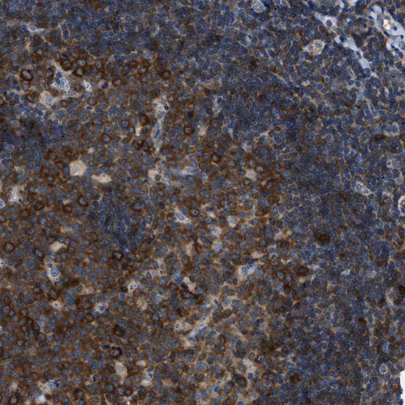 PFKP Antibody - BSA Free Immunohistochemistry: PFKP Antibody - BSA Free [NBP1-92256]