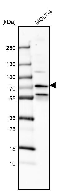 PHF22 Antibody - BSA Free Western Blot: PHF22 Antibody - BSA Free [NBP1-92263]