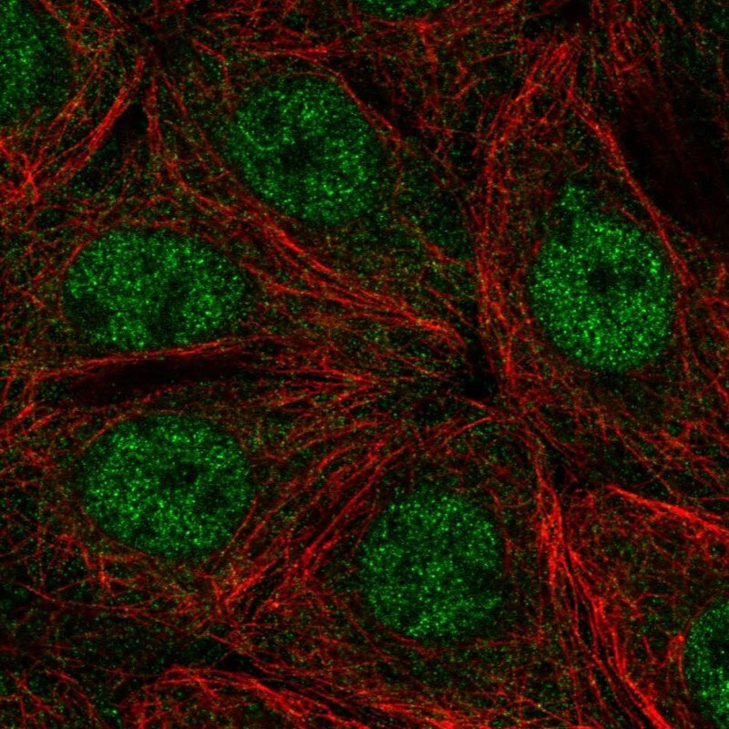 PHKA2 Antibody - BSA Free Immunocytochemistry/ Immunofluorescence: PHKA2 Antibody - BSA Free [NBP1-92264]