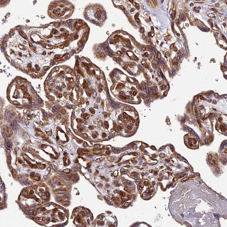 Phosphodiesterase 4D Antibody - BSA Free Immunohistochemistry: Phosphodiesterase 4D Antibody - BSA Free [NBP1-92265]