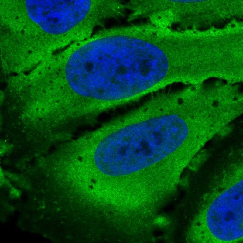 Phosphodiesterase 4D Antibody - BSA Free Immunocytochemistry/ Immunofluorescence: Phosphodiesterase 4D Antibody - BSA Free [NBP1-92265]