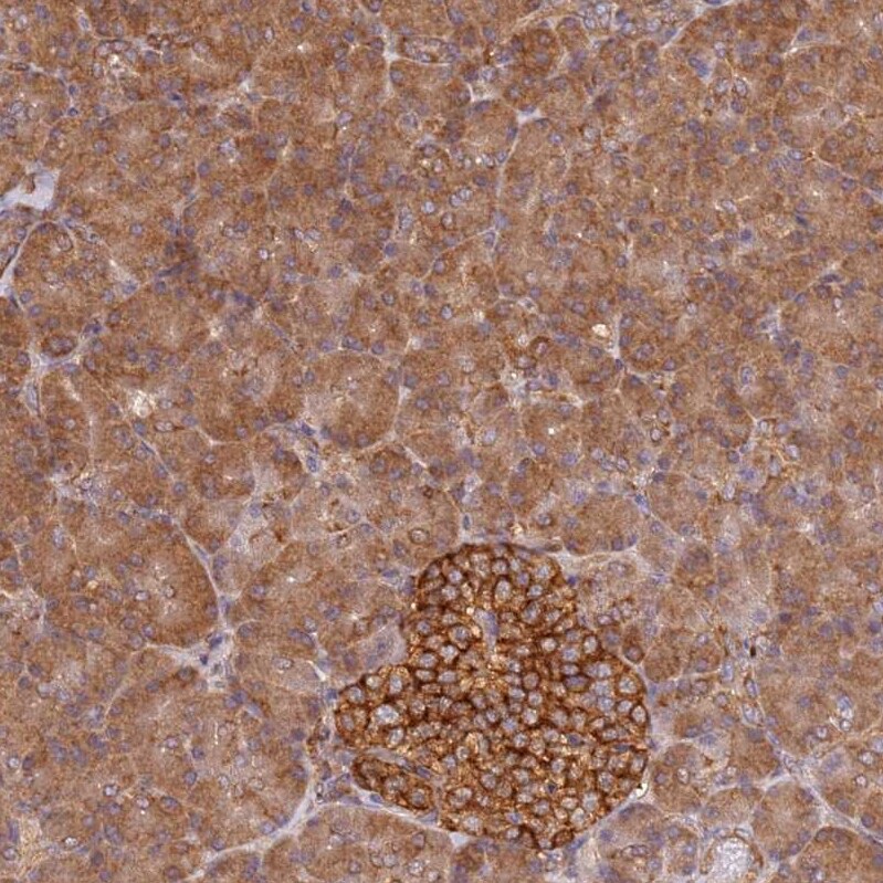 PIH1D1 Antibody - BSA Free Immunohistochemistry: PIH1D1 Antibody - BSA Free [NBP1-92269]