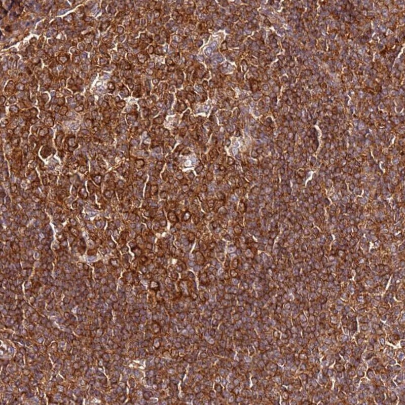 PIH1D1 Antibody - BSA Free Immunohistochemistry: PIH1D1 Antibody - BSA Free [NBP1-92269]