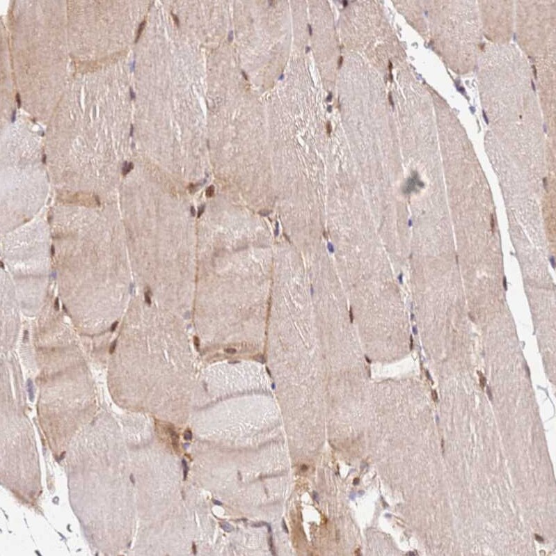 PIH1D1 Antibody - BSA Free Immunohistochemistry: PIH1D1 Antibody - BSA Free [NBP1-92269]