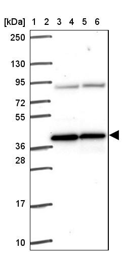 PIH1D1 Antibody - BSA Free Western Blot: PIH1D1 Antibody - BSA Free [NBP1-92269]