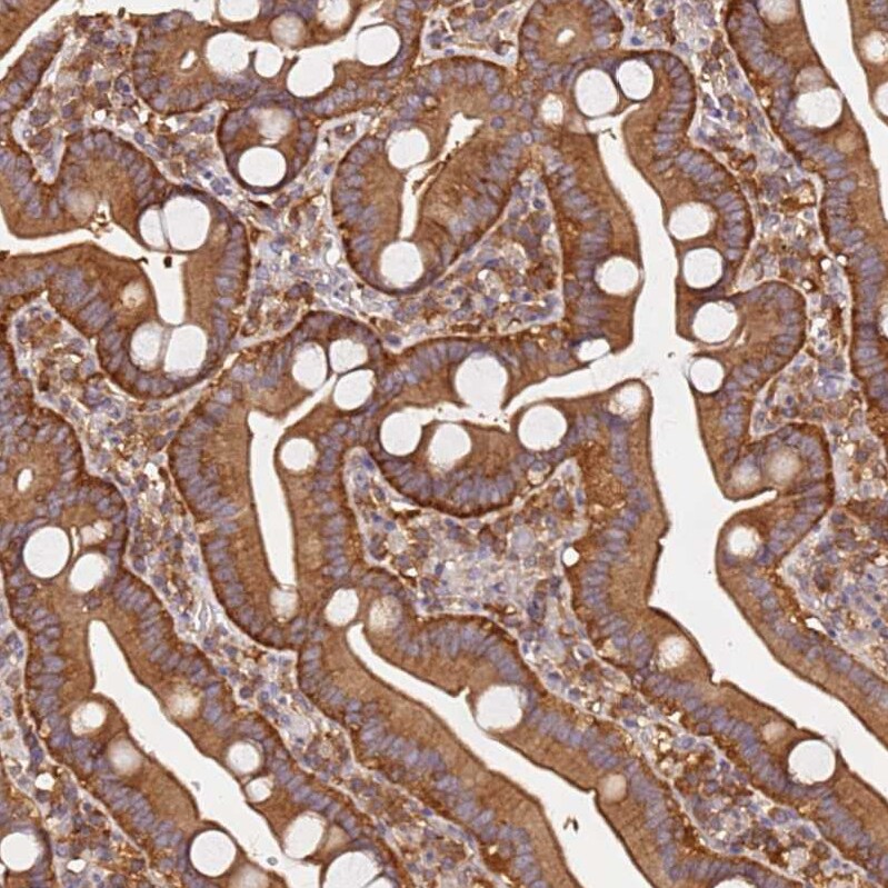 PIH1D1 Antibody - BSA Free Immunohistochemistry: PIH1D1 Antibody - BSA Free [NBP1-92269]