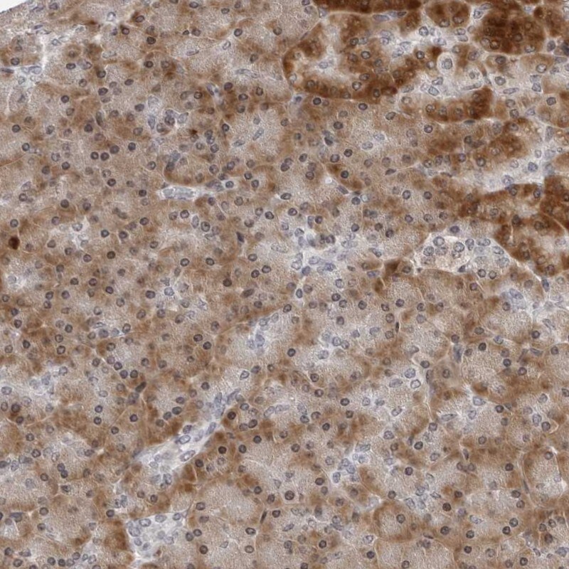 PIP5K2 gamma Antibody - BSA Free Immunohistochemistry: PIP5K2 gamma Antibody - BSA Free [NBP1-92272]