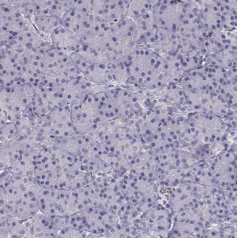 Pit1 Antibody - BSA Free Immunohistochemistry: Pit1 Antibody - BSA Free [NBP1-92273]