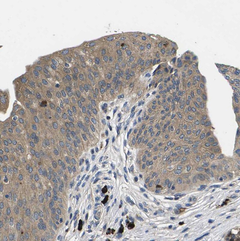 PLEC1 Antibody - BSA Free Immunohistochemistry: PLEC1 Antibody - BSA Free [NBP1-92275]