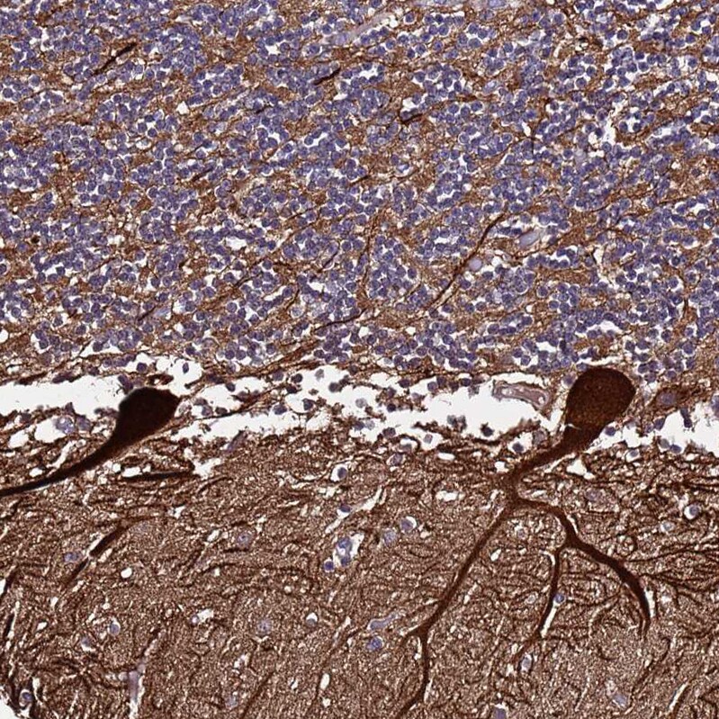 Plxdc2 Antibody - BSA Free Immunohistochemistry: Plxdc2 Antibody - BSA Free [NBP1-92278]