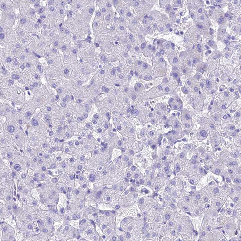 PrPC Antibody - BSA Free Immunohistochemistry: PrPC Antibody - BSA Free [NBP1-92285]
