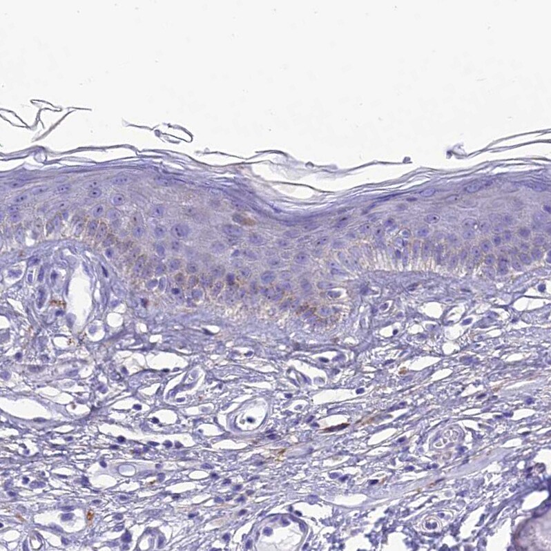 PrPC Antibody - BSA Free Immunohistochemistry: PrPC Antibody - BSA Free [NBP1-92285]