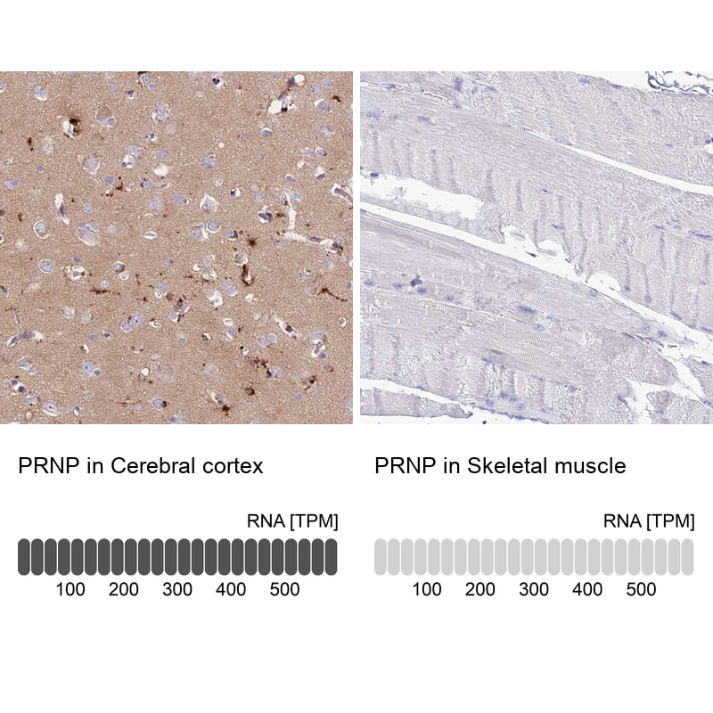 PrPC Antibody - BSA Free Immunohistochemistry: PrPC Antibody - BSA Free [NBP1-92285]