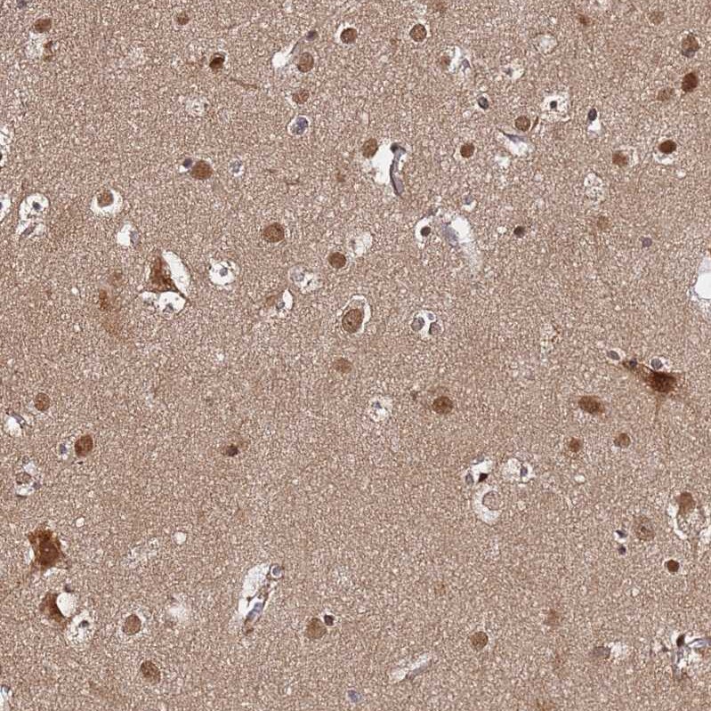 AMPK beta 2/PRKAB2 Antibody - BSA Free Immunohistochemistry: AMPK beta 2/PRKAB2 Antibody - BSA Free [NBP1-92286]