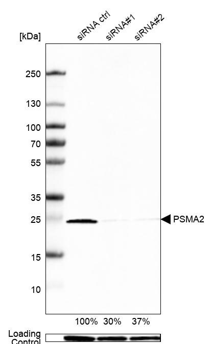 PSMA2 Antibody - BSA Free Western Blot: PSMA2 Antibody - BSA Free [NBP1-92292]