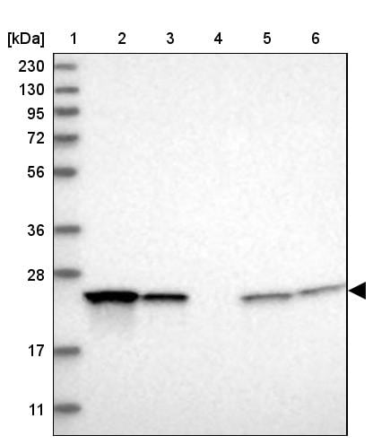 Proteasome 20S beta2 Antibody - BSA Free Western Blot: Proteasome 20S beta2 Antibody - BSA Free [NBP1-92294]