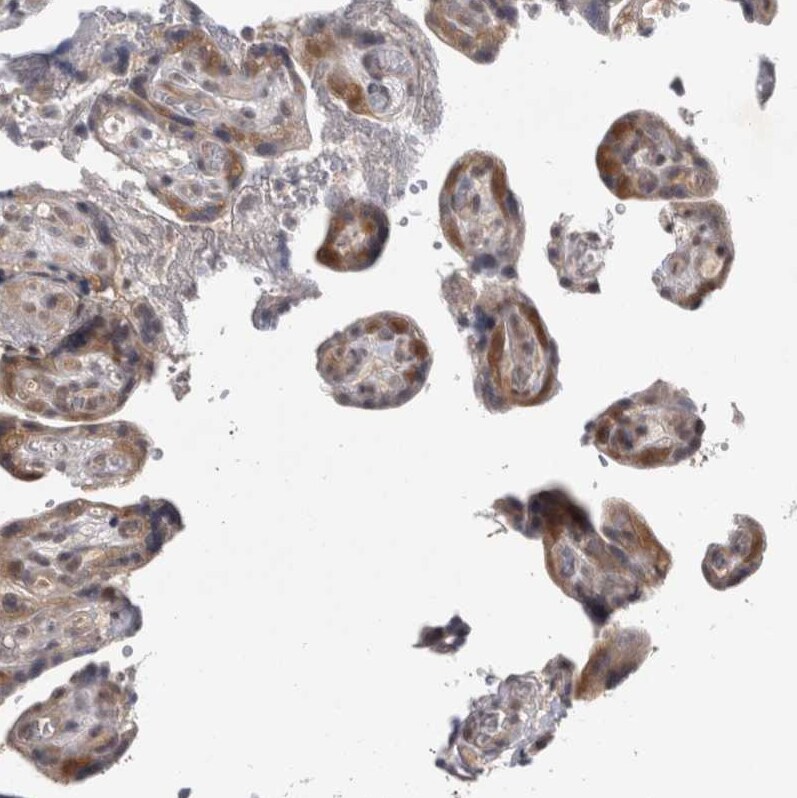 Proteasome 20S beta2 Antibody - BSA Free Immunohistochemistry: Proteasome 20S beta2 Antibody - BSA Free [NBP1-92294]