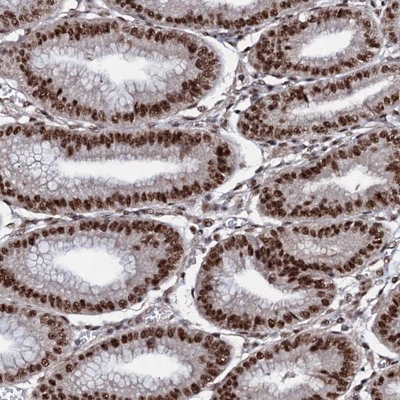 PRP18 Antibody - BSA Free Immunohistochemistry-Paraffin: PRP18 Antibody [NBP1-92297]