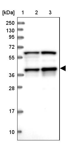 PRP18 Antibody - BSA Free Western Blot: PRP18 Antibody - BSA Free [NBP1-92297]