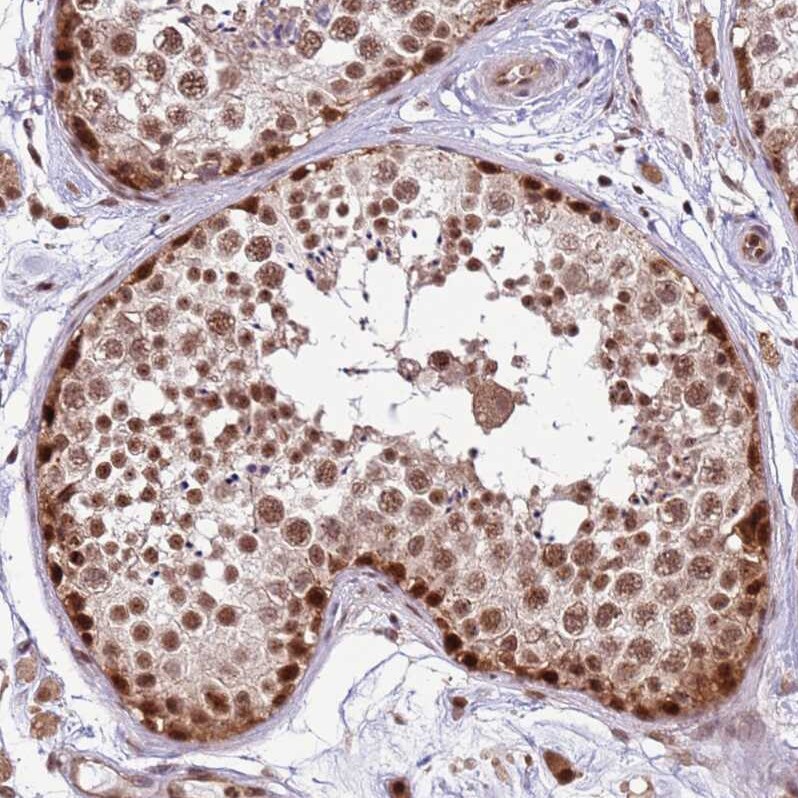 PRPF6 Antibody - BSA Free Immunohistochemistry: PRPF6 Antibody - BSA Free [NBP1-92298]