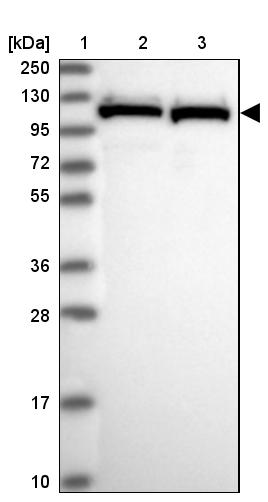 PRPF6 Antibody - BSA Free Western Blot: PRPF6 Antibody - BSA Free [NBP1-92298]