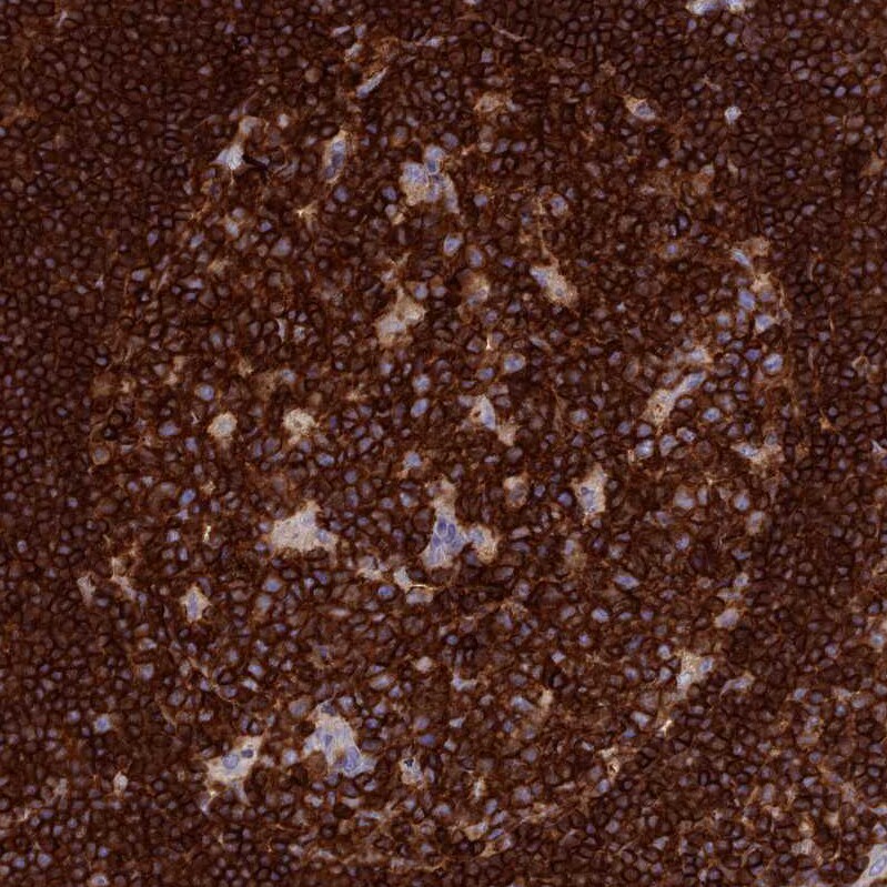 PTPRCAP Antibody - BSA Free Immunohistochemistry: PTPRCAP Antibody - BSA Free [NBP1-92304]