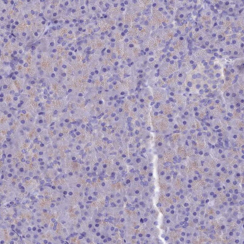 PTPRCAP Antibody - BSA Free Immunohistochemistry: PTPRCAP Antibody - BSA Free [NBP1-92304]