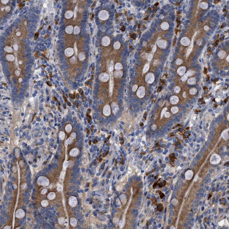 RAG1AP1 Antibody - BSA Free Immunohistochemistry: RAG1AP1 Antibody - BSA Free [NBP1-92311]