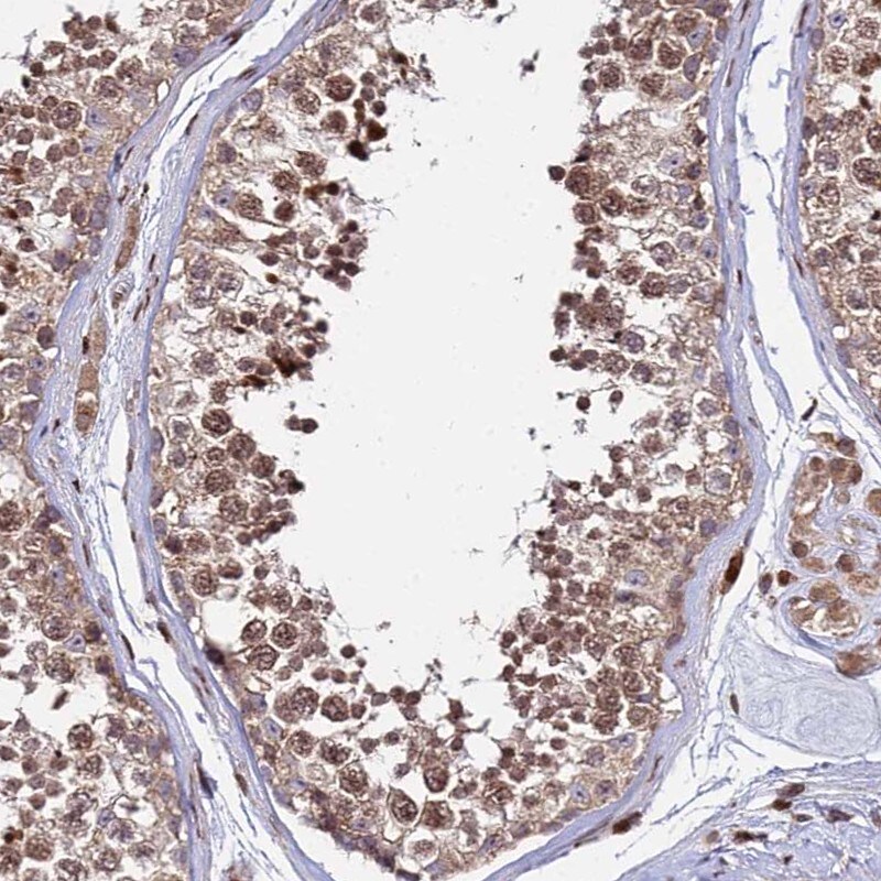 RBMS2 Antibody - BSA Free Immunohistochemistry-Paraffin: RBMS2 Antibody [NBP1-92321]