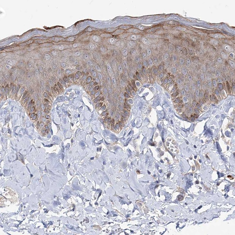 RICS Antibody - BSA Free Immunohistochemistry-Paraffin: RICS Antibody [NBP1-92334]