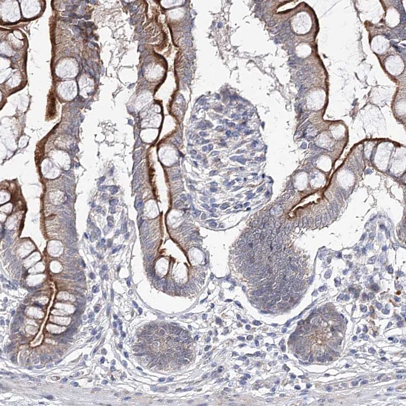 RICS Antibody - BSA Free Immunohistochemistry-Paraffin: RICS Antibody [NBP1-92334]