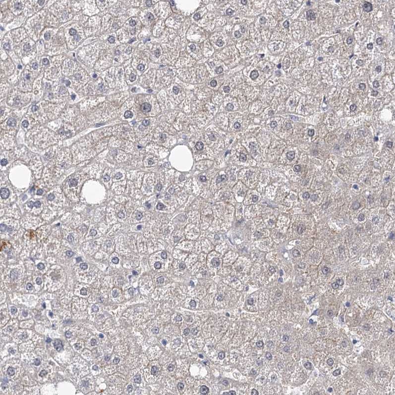 RICS Antibody - BSA Free Immunohistochemistry-Paraffin: RICS Antibody [NBP1-92334]