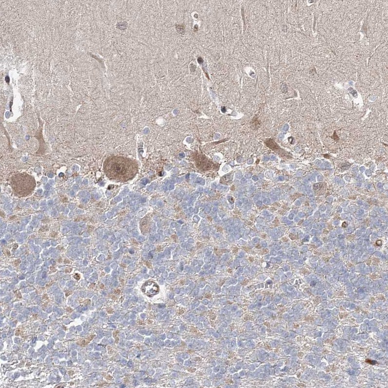RICS Antibody - BSA Free Immunohistochemistry-Paraffin: RICS Antibody [NBP1-92334]