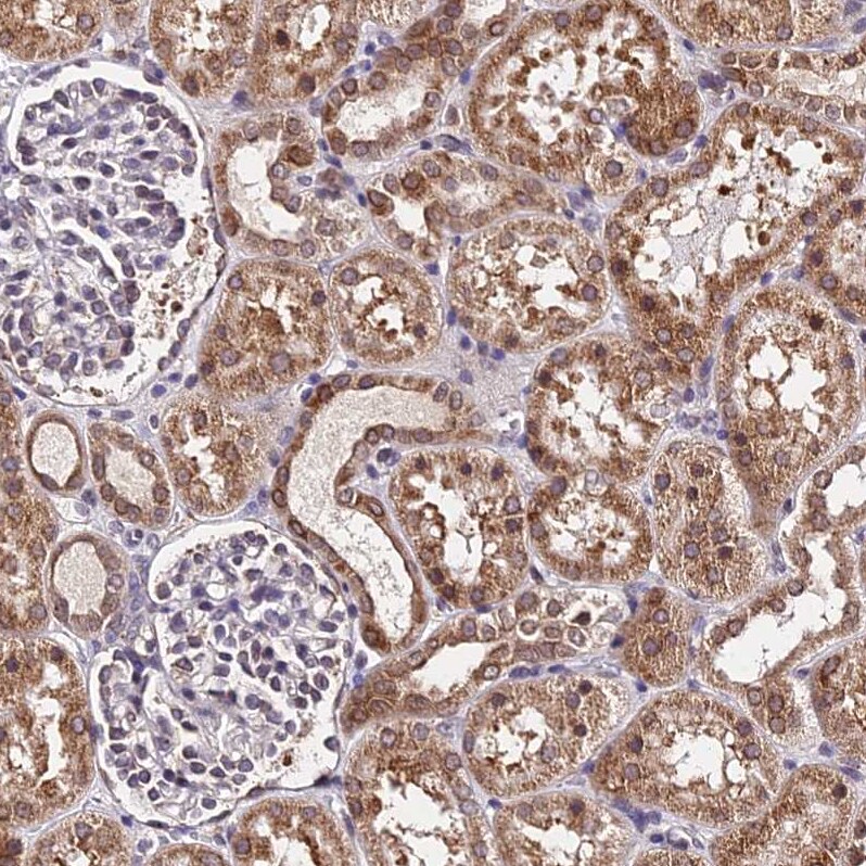 RNF121 Antibody - BSA Free Immunohistochemistry: RNF121 Antibody - BSA Free [NBP1-92339]