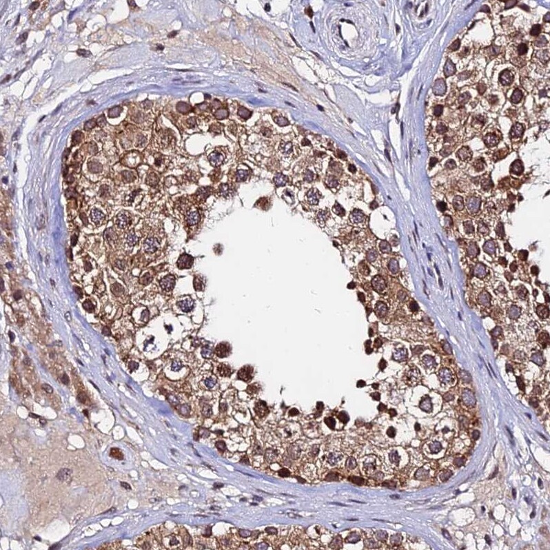 RNF121 Antibody - BSA Free Immunohistochemistry: RNF121 Antibody - BSA Free [NBP1-92339]