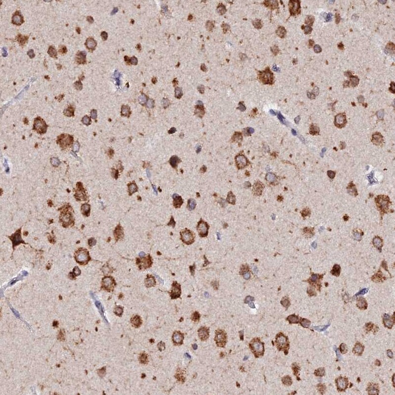 RNF121 Antibody - BSA Free Immunohistochemistry: RNF121 Antibody - BSA Free [NBP1-92339]